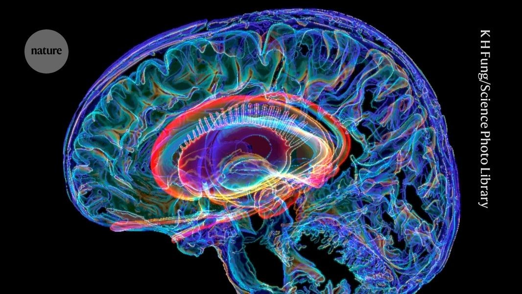 Colorful illustration showing enhanced connections between different regions of the human brain