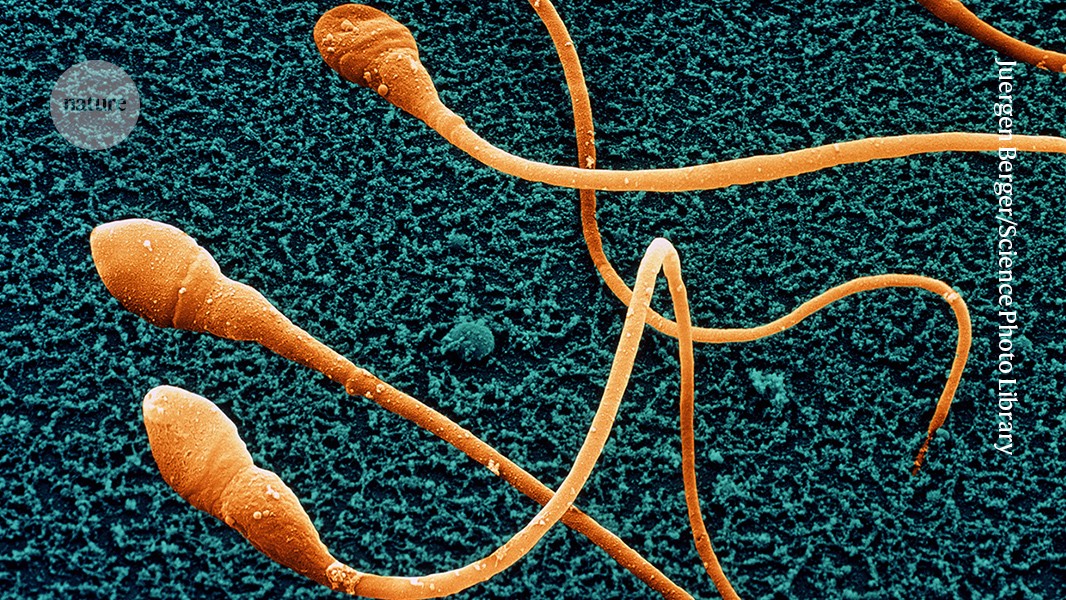 Scientists Create Early Human Sperm Cells in Major Leap