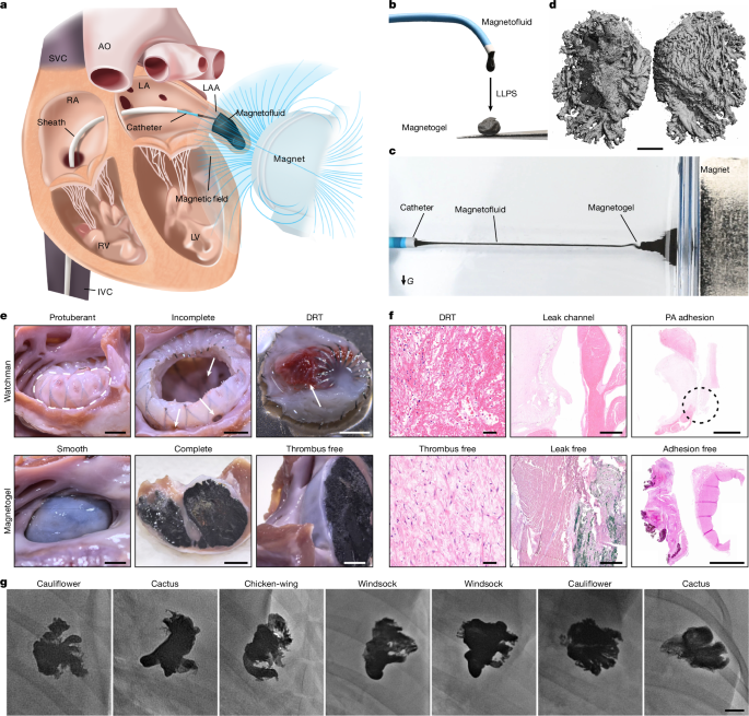 Magnetic Gel Prevents Strokes Without Blood Clots