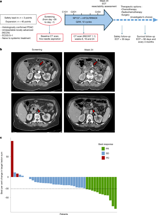 New Drug Combo Doubles Survival Time for Pancreatic Cancer