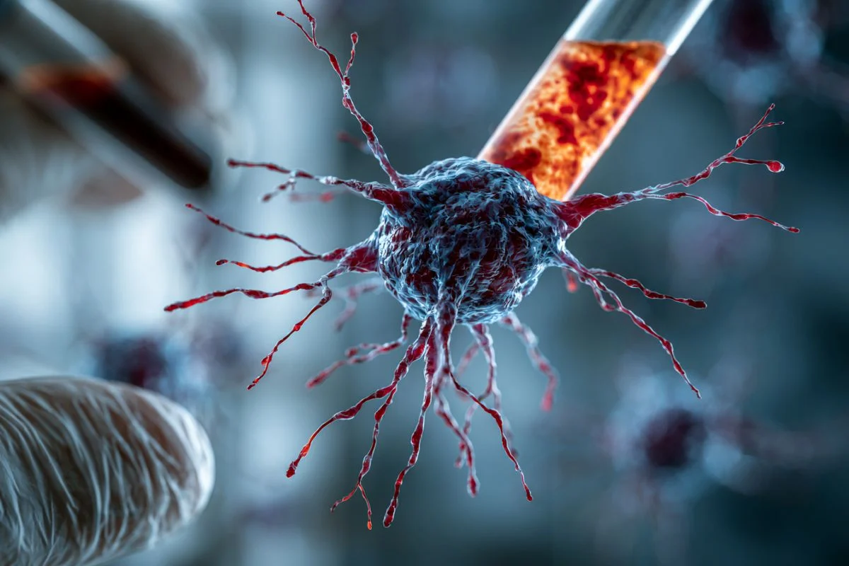 Blood Test Predicts Alzheimer's Risk 5 Years Early