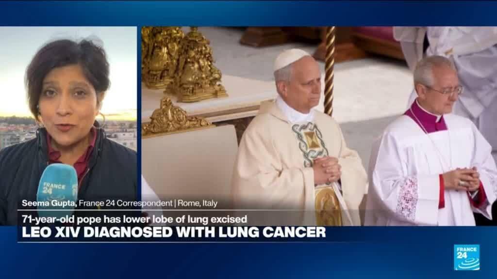 Pope Leo XIV Celebrates Mass Days After Lung Cancer Surgery - Image 3