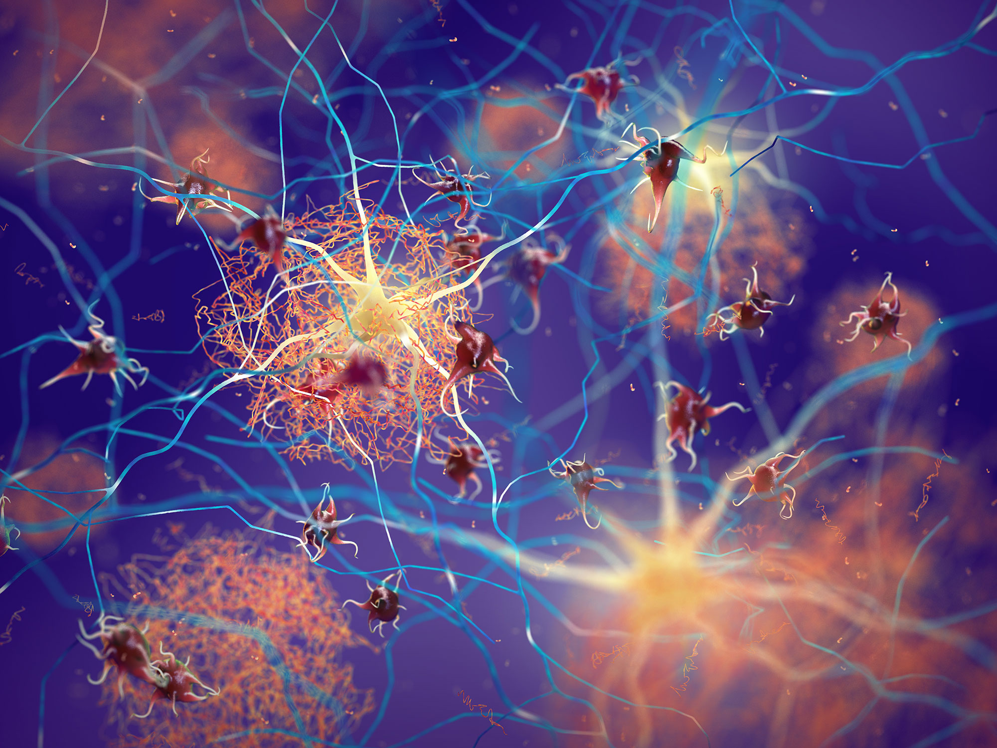 Scientists Find Natural Molecule That Blocks Alzheimer's