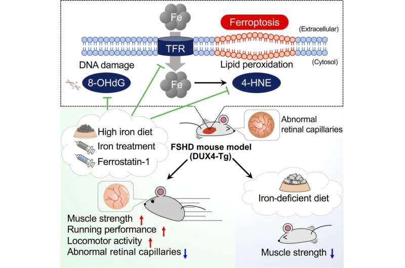 Iron Supplements Restore Muscle Strength in Dystrophy Study - Image 2