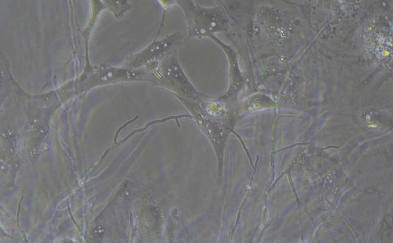 Scientists Crack Mystery of Bat Disease Killing Millions - Image 4