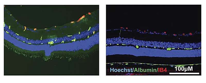 U-M Scientists Find Molecule to Halt Vision Loss - Image 2