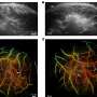 New Brain Surgery Patch Seals in 5 Seconds With Light - Image 4