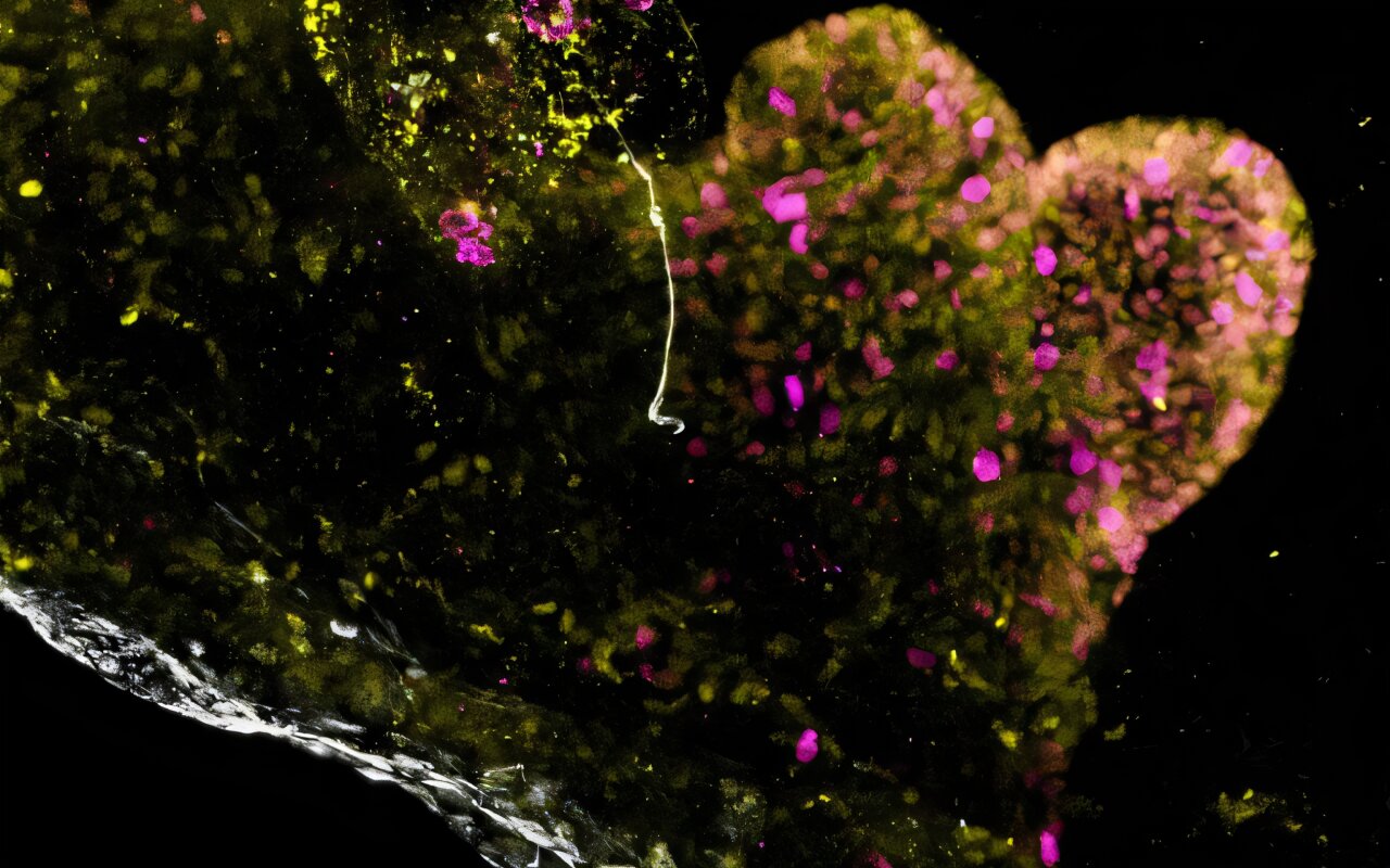 Fluorescent microscope image showing colorful cell structures inside a lab-grown mini-stomach organoid