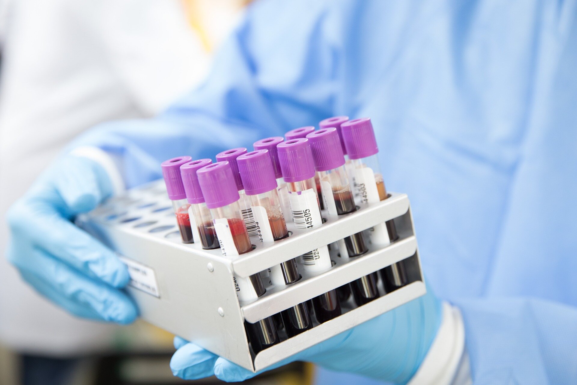 Simple Blood Test Spots Lung Damage After COVID-19
