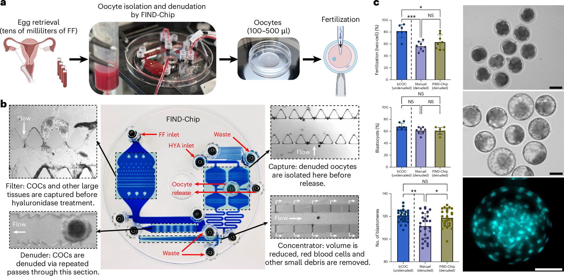 Microfluidic FIND-Chip device with tiny channels designed to recover missed eggs during IVF treatment