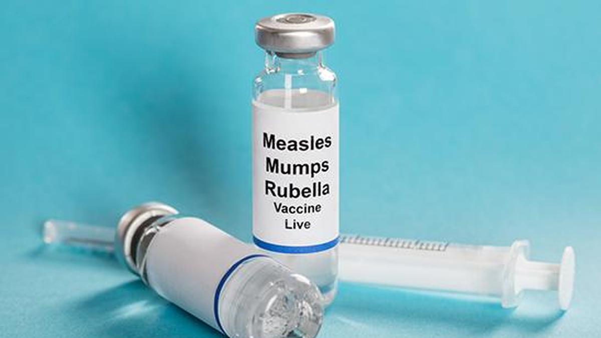 Chennai Hits 99% Vaccination Rate, Measles Cases Stay Low