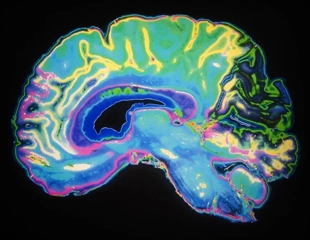 Scientists Find Brain Waves That Spiral Like Weather Patterns