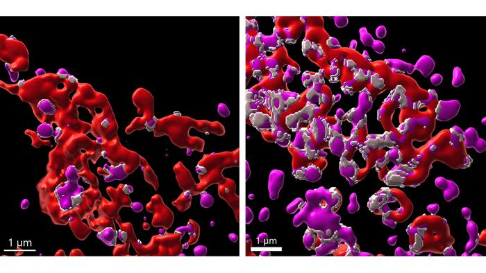 Michigan Team Finds Immune System Kills Cancer With Iron
