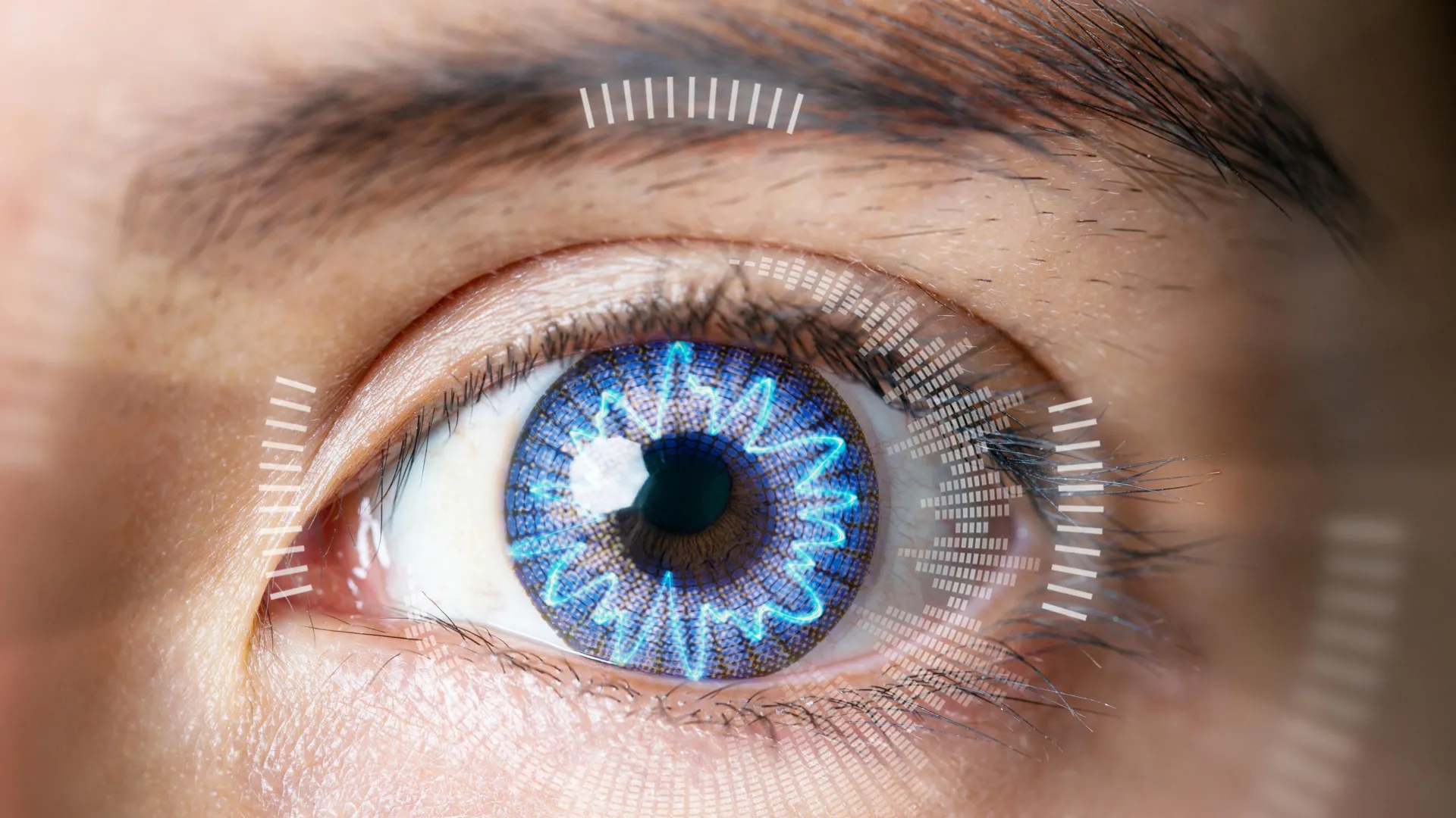 New Method Reshapes Eyes Without Surgery in 60 Seconds