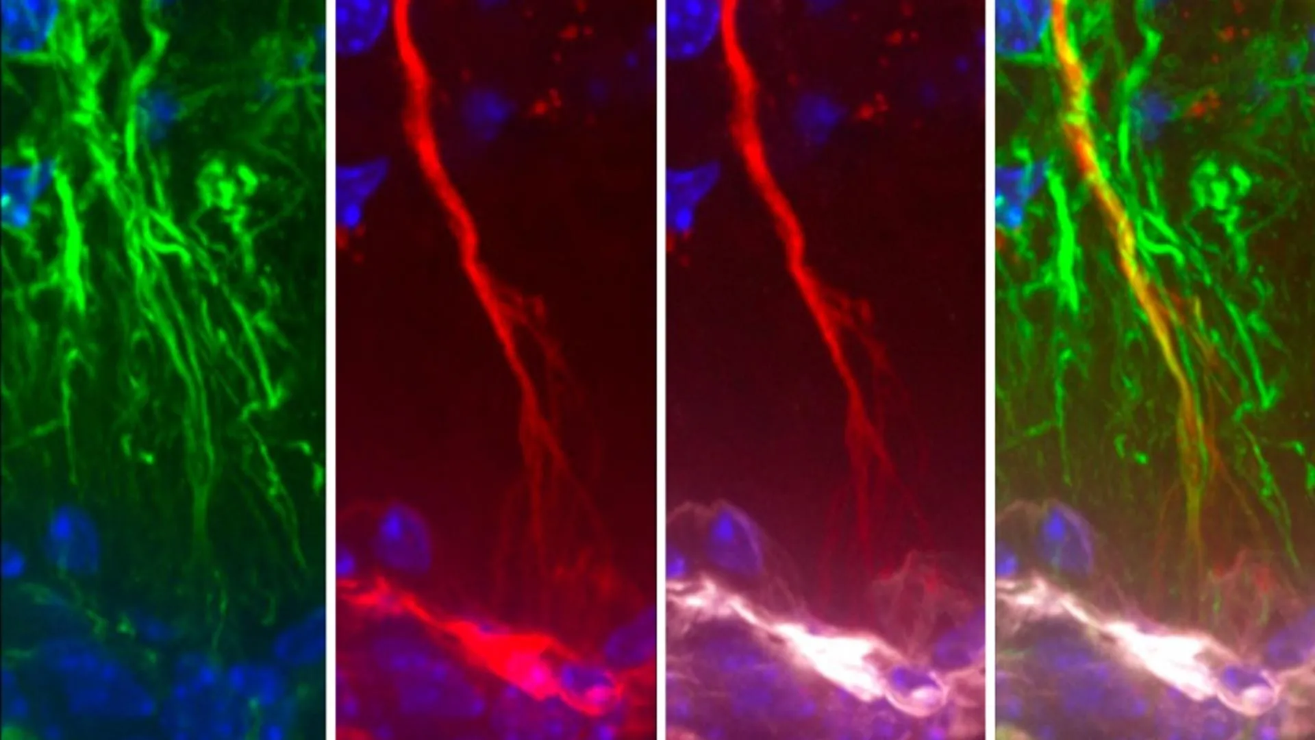 Brain's Hidden Cleaners May Unlock Alzheimer's Treatment