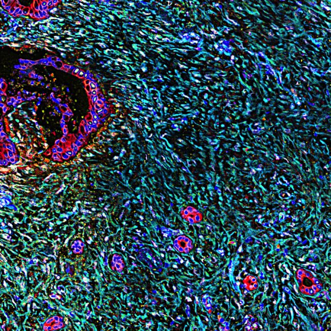 New Cancer Drug Shrinks Tumors in 62% of Lung Patients - Image 2